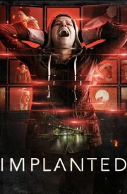 Implanted