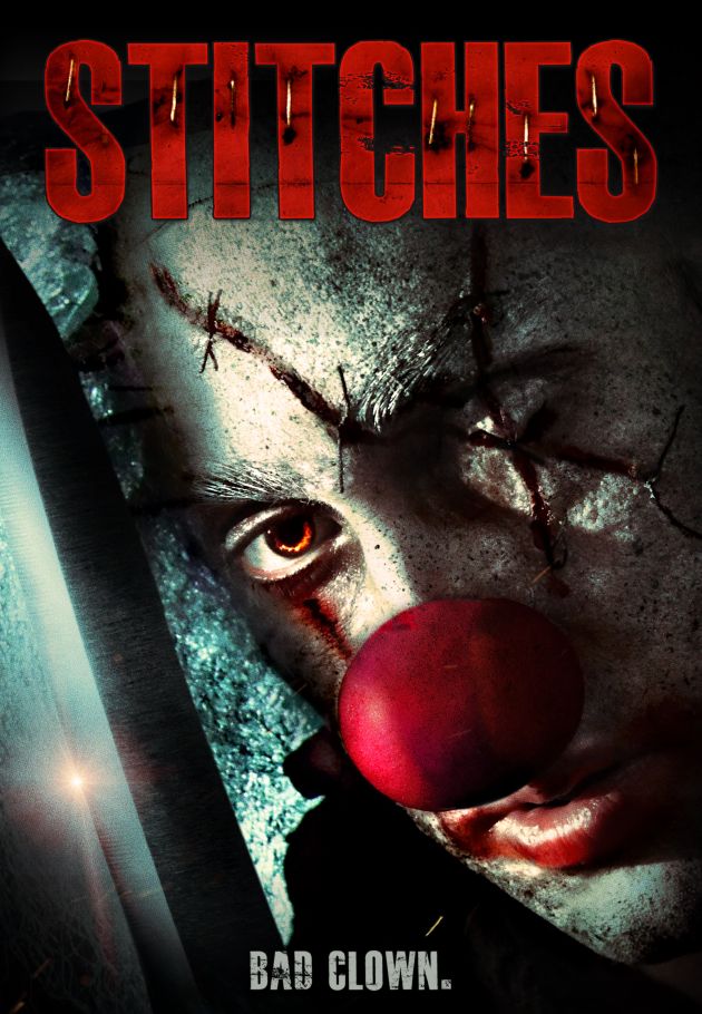 Stitches