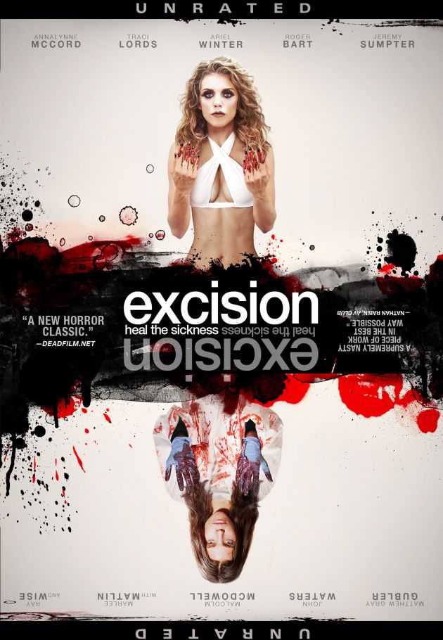 Excision